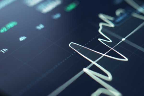 “大空头”挤压，美元即将迎来反弹？